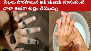 Easy way to remove pen ink stains and sketch  from hands &skin