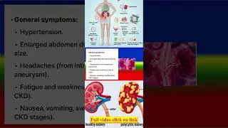Signs and Symptoms of Polycystic Kidney Disease (PKD)#medicalknowledgeonline #science #medicaldiagn