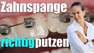 feste Zahnspange RICHTIG putzen: FATALE FEHLER
