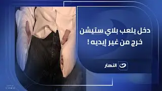 شاب دخل يلعب بلاى ستيشن طلع من غير ايديه والسبب صادم