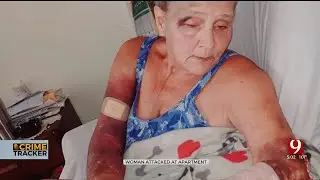 Search Underway For Suspect Accused Of Beating 64-Year-Old Woman In Del City