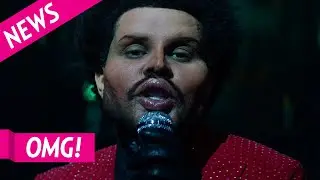 OMG! What Did The Weeknd Do to His Face?!
