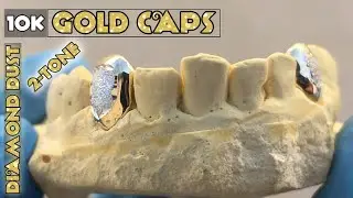 Diamond Dust Solid 10K Gold Tooth Custom Caps Two Tone Teeth Single Grillz