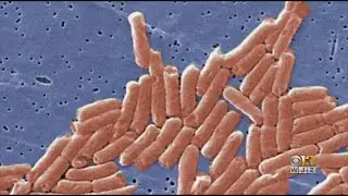 Health Department Investigating Salmonella Cases Linked To Hummus