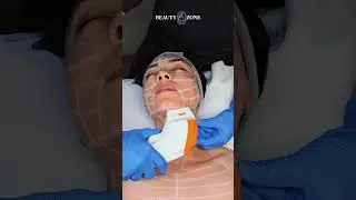 HIFU 12D &iexcl;La m&aacute;s nuevo para lifting sin cirug&iacute;a!