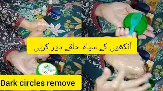 Dark circles remove /Homemade remedy for under eyes #foryou #trending  #viral #skin