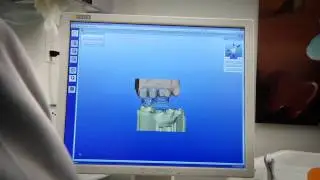 CEREC  AC Biogeneric Workflow