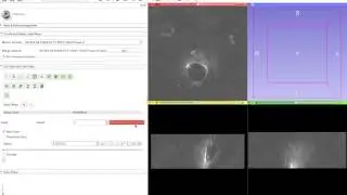 3D Slicer: MultiVolume support demo