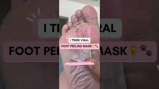 VIRAL FOOT PEELING MASK | TONIMOLY FOOT PEELING MASK #softfeet #peelingasmr #tonymoly #crackedfeet
