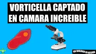 Protozoo Vorticella Aliment&aacute;ndose (Microscopio)