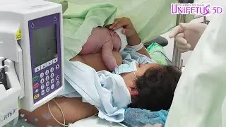🌸🤩🌸Parto Humanizado 26-07-2021, 😇 UNIFETUS 🩺Ginec&oacute;loga Obstetra Nicol Corredor Perinatologo🌸💝🙏