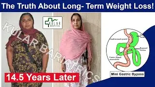 14.5 Years Later: The Truth About Long- Term Weight Loss!@kskular