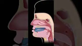 Dental Estetik Merkezi / Uyku Apnesi Nedir?