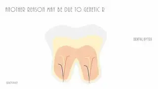 DENTAL BYTES : STOP sensitive tooth pain COLD!