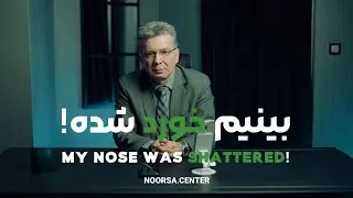 بینیم خورد شد!|MY NOSE WAS SHATTERED!