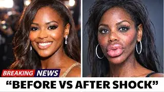 10 Black Celebrities Who Destroyed Their Faces With Plastic Surgery &ndash; Truly Tragic
