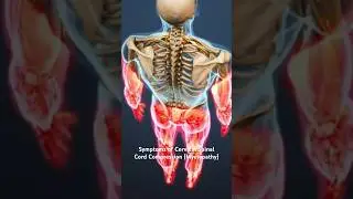 Symptoms of Cervical Spinal Cord Compression (Myelopathy)
