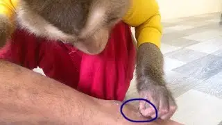 Awesome Jason Grooming Remove Healing Skin Cell On Feet Dad