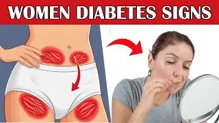 4 Hidden Diabetes SYMPTOMS in Women You Can't Ignore