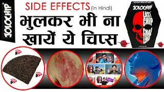 Jolochip Side Effects | jolo chips challenge🔥 | Carolina Reaper Chip | इसे खाना एक भारी गलती है