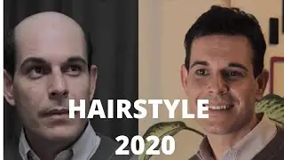 PROTESI CAPELLI 2 PRIMA E DOPO / HAIR SYSTEM 2 BEFORE AND AFTER TRANSFORMATION/ PROTESIS CAPILAR