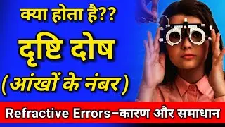 चश्मे के नंबर के प्रकार, type of refractive errors, chashma kyu ata hai? What are Refractive Errors?