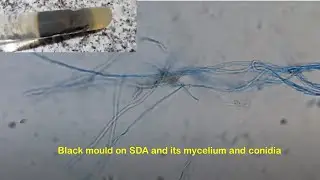 Black mould on SDA and its mycelium and conidia
