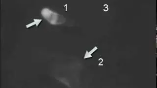 in-situ TEM of Pd-H hydrogen absorption