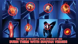 SPIN RUQYAH - DESTROY Djinn, MAGIC THAT LIVE IN ROOMS, HOUSES & BODY | ALAA AQEL