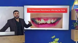 Development of dentition lec8 part 2 شرح تقويم أسنان للمرحلة الرابعة