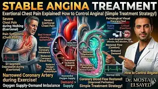 Stable angina treatment شرح