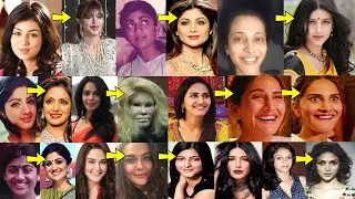 Top 10 Bollywood Actresses who Looks Horrible after their Shocking Plastic Surgery | Before & After