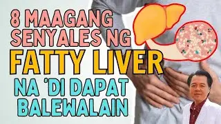 8 Maagang Senyales ng Fatty Liver Na Hindi Dapat Balewalain. - By Doc Willie Ong