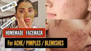 omg 🤯 |Under ₹100 ‼️HOMEMADE FACEMASK 😱🤯| #homemade #homemadefacemasks #  | #diyfacemask #homemade
