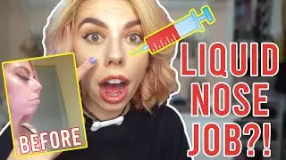 I GOT A NOSE JOB! - GETTING A LIQUID RHINOPLASTY (NOSE JOB)