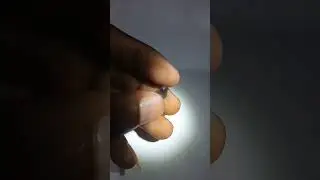 spinal (part13)💎 from SriLanka