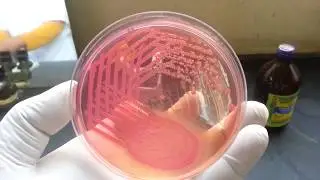 Isolated pure colony from mixed growth