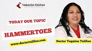 Hammertoes Explained: Causes & Benefits of Minimally Invasive Surgery (MIS)