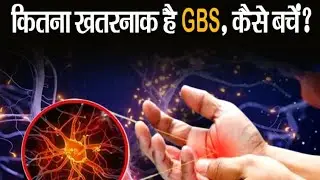Part 2 gbs physiotherapy treatment  paralysis exercisefor hand and leg  guillain barre syndrome.