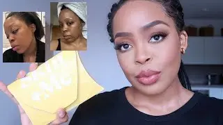 SKIN + ME DAILY DOSER: ОБЗОР 1 МЕСЯЦА | УСТРАНЕНИЕ ПИГМЕНТАЦИИ