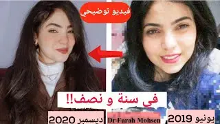 هل سنة و نص فترة كافية؟!! تحول شعري تماما بعد معاناه ١٥ سنة ! *فيديو توضيحي* | HAIR TRANSFORMATION