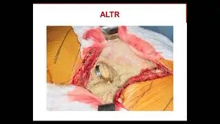 Adult reconstruction hip Miller review 2019