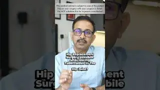 Hip Replacement Surgery after TB of hip joint #tbtreatment #hiparthritis #shortsindia